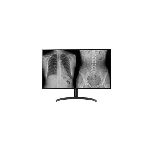 [32HL512D-B] ECRAN LG 32 NOIR LED IPS 16:9 8MP DCI-P3 98% 5ms 350cd/m  UHD 3840x2160. Flicke