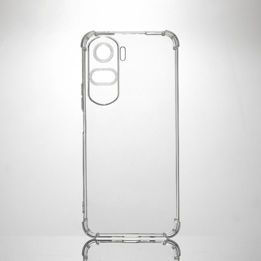 [WEBUNTPUH90LITE] ***WE PACK verre trempé et coque de protection transparente HONOR 90 LITE